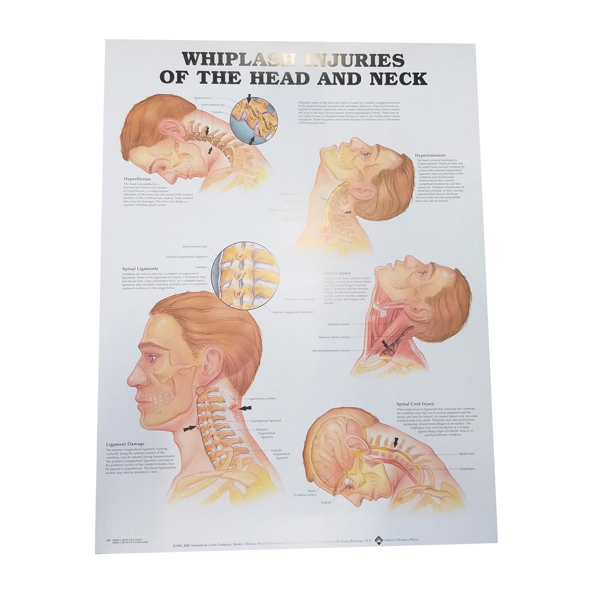 Whiplash Vs. Other Neck Injuries Differentiating And Diagnosing In California Cases