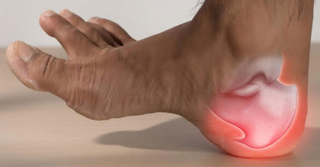 Treatment of Plantar Fasciitis