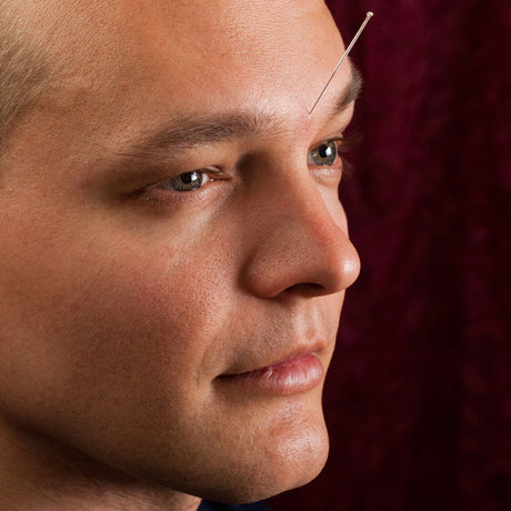 Hvad siger forskningen om akupunktur? En guide til effekt og evidens